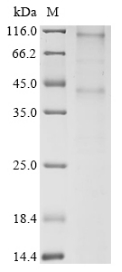 SDS-PAGE