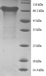 SDS-PAGE