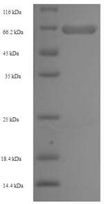SDS-PAGE