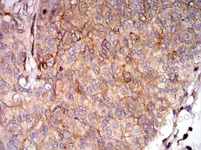 Валидация AntibodySystem RHM00202