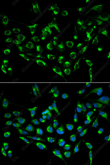 Иммунофлуоресценция, CDKN3, клетки MCF-7