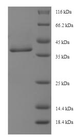 SDS-PAGE