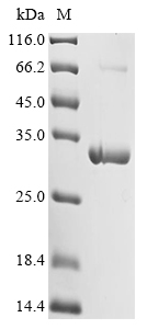SDS-PAGE