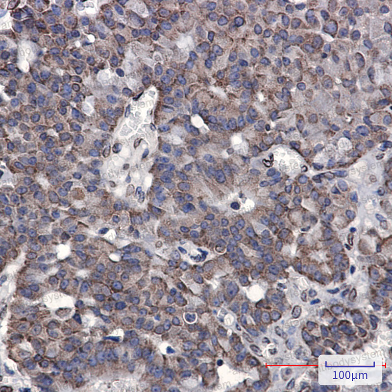 Валидация AntibodySystem RHN89501