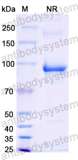 Валидация SDS-PAGE - AntibodySystem RVV08903