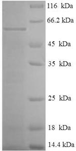 SDS-PAGE
