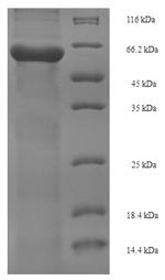 SDS-PAGE