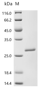SDS-PAGE