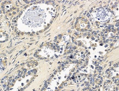 Валидация Affinity DF15255 - 11536