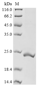 SDS-PAGE