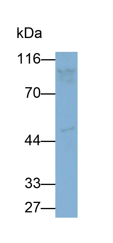 32544