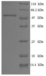 SDS-PAGE