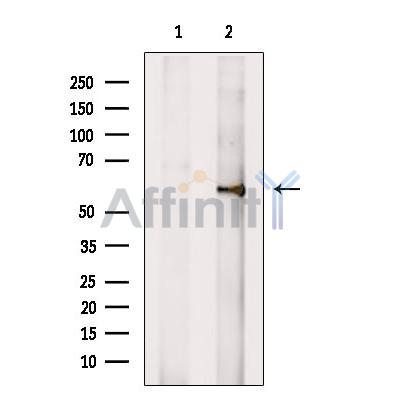 Валидация Affinity DF7425 - 19167