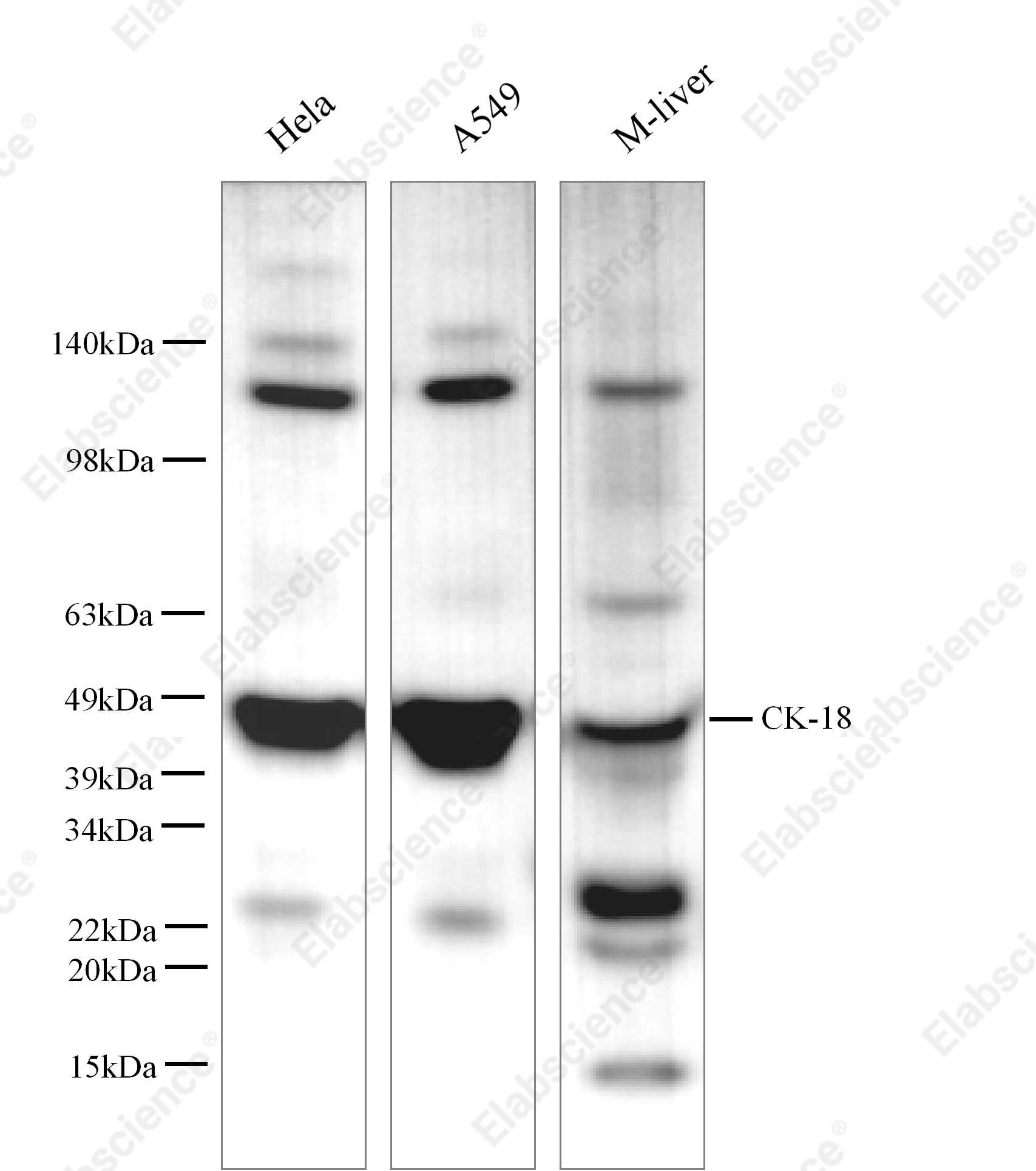 Вестерн-блоттинг, CK-18, клеточные линии HepG2, HeLa, A549, K562