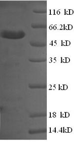 SDS-PAGE