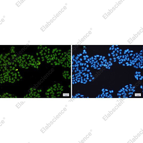 Иммунофлуоресценция, Topoisomerase I, клетки HeLa