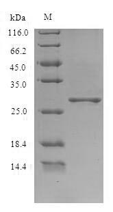 SDS-PAGE