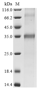 SDS-PAGE