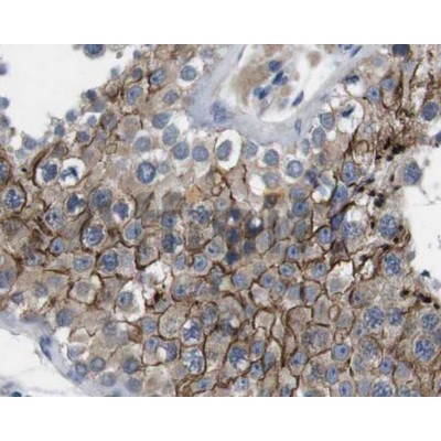 Валидация Affinity AF5012 - 2443