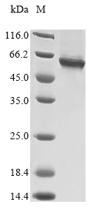 SDS-PAGE