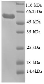 SDS-PAGE