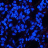 Иммунофлуоресценция, Phospho-CHEK2 (Thr68), ткань легкого крысы