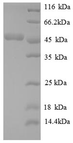 SDS-PAGE