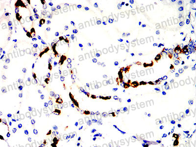 Валидация AntibodySystem RHN98902