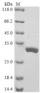 SDS-PAGE