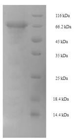 SDS-PAGE
