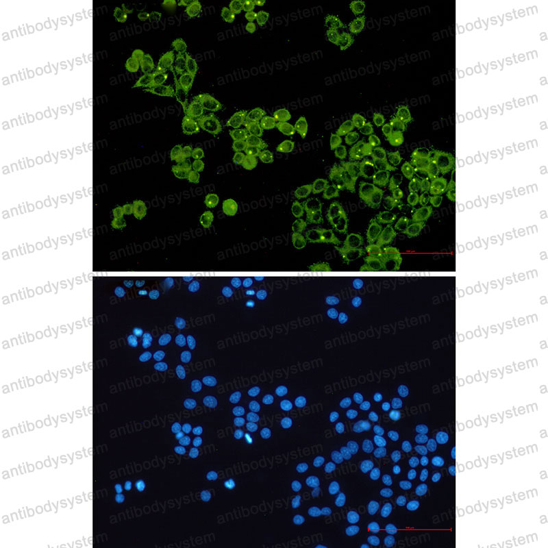 Валидация IF - AntibodySystem RHD01605