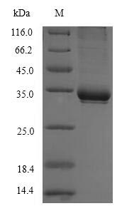 SDS-PAGE