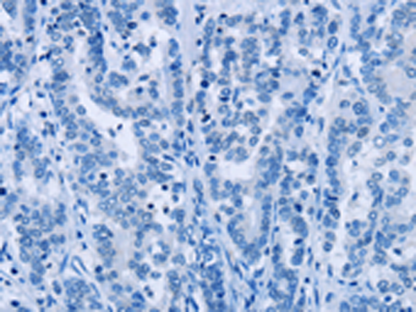 Валидация AssayVector ARM1693(1947)