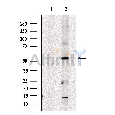 Валидация Affinity DF7106 - 18753