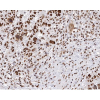 Валидация Affinity AF6251 - 3500