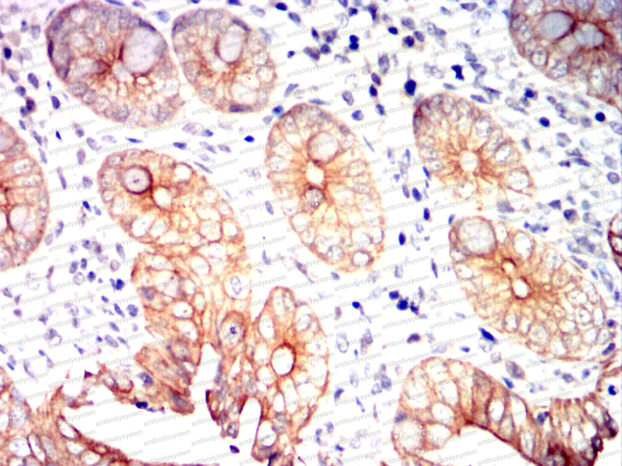 Валидация AntibodySystem RHD34504
