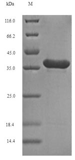 SDS-PAGE