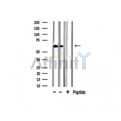 Валидация Affinity AF6162 - 3379