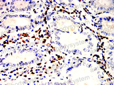 Валидация AntibodySystem RHD69205 (1727)