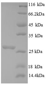 SDS-PAGE