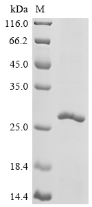 SDS-PAGE