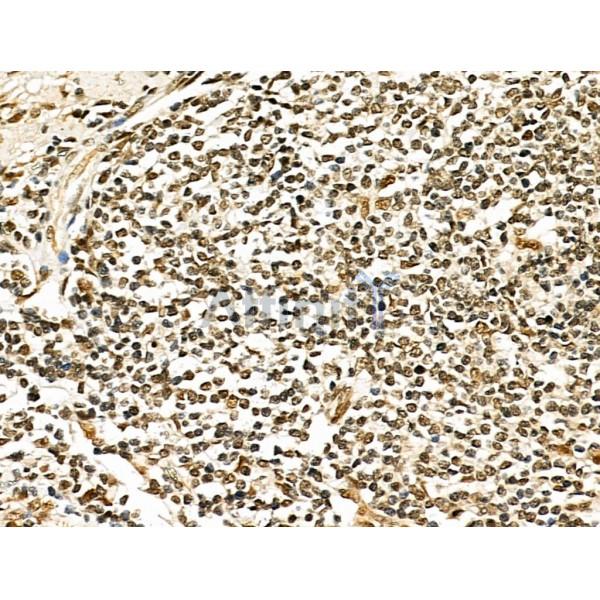 Валидация Affinity DF6200 - 17458