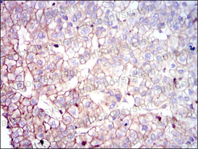 Валидация AntibodySystem RHG69202