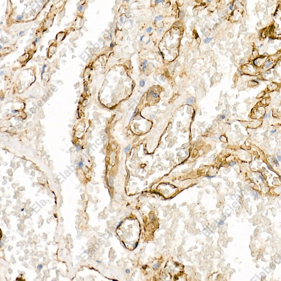 Иммуногистохимия, CD141/Thrombomodulin, ткань легкого человека