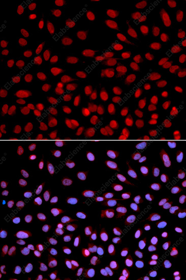 Иммунофлуоресценция, DNA polymerase eta, клетки U2OS