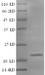 SDS-PAGE