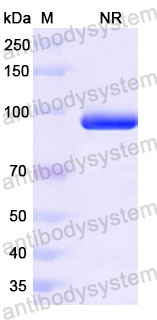 Валидация SDS-PAGE - AntibodySystem RVV08904