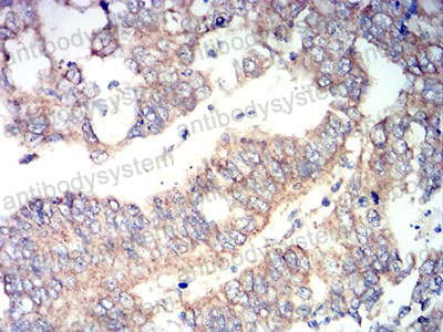 Валидация AntibodySystem RHG64302