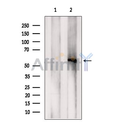 Валидация Affinity AF6381 - 3676