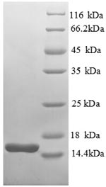 SDS-PAGE